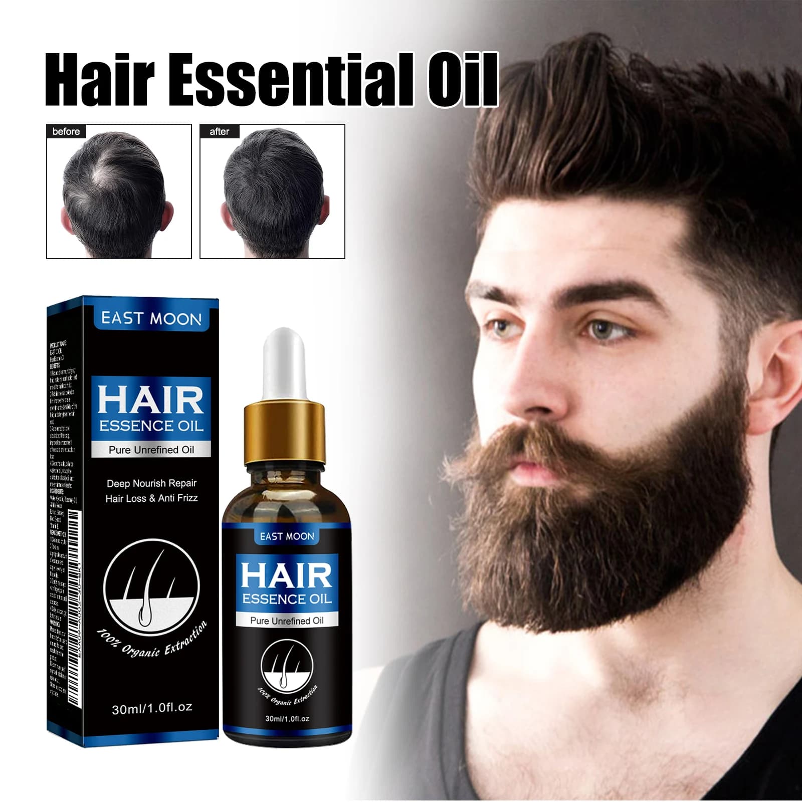 Essenza per capelli da uomo East Moon da 30 ml Supplemento forte e resistente Nutriente Idratare Prevenire la caduta Soluzione per la cura dei capelli densa assorbibile