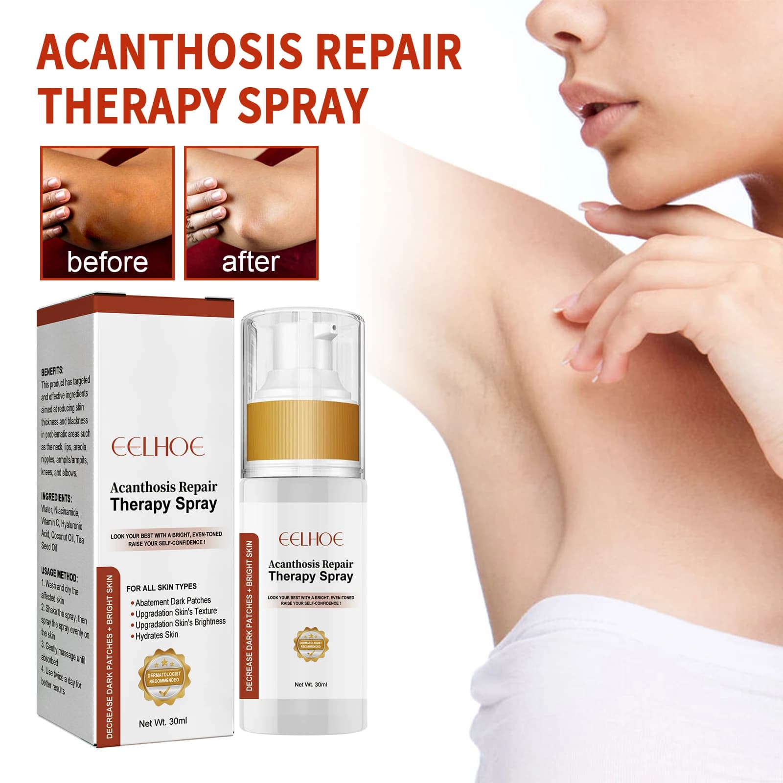 Eelhoe 30ml Black Thorn Spray per la cura della pelle Dissolvenza Pelle scura Pulisci Articolazioni cornee Riparazione Ascelle Melanina Nutriente Schiarente Spray per il corpo