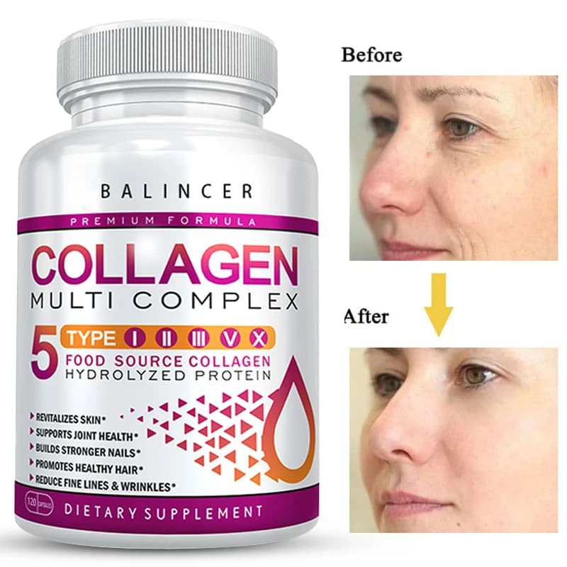 Collagen Complex – Nutritional Supplement That Helps Whiten & Brighten Skin, Joints, Nails, Hair Support, and Relieve Fine Lines