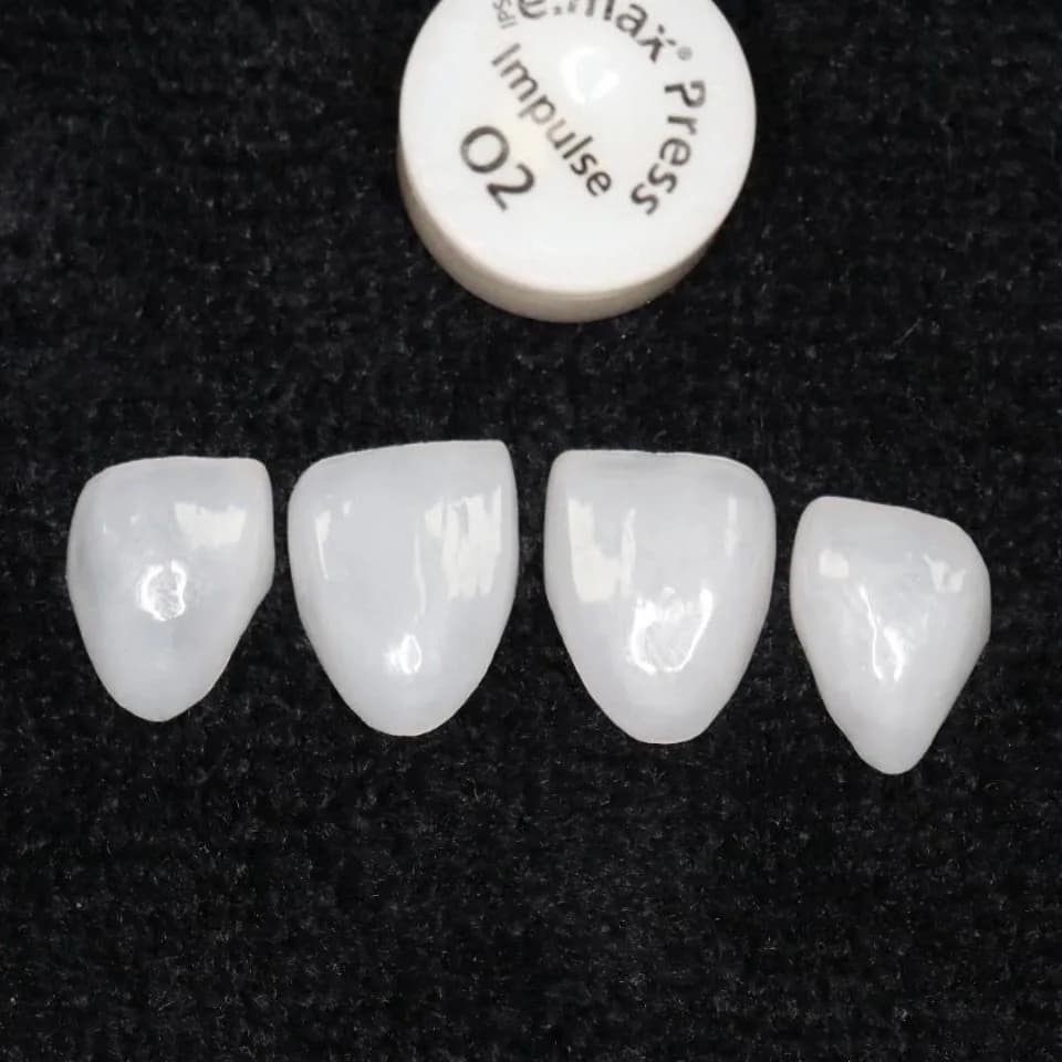 No. 41 #2PCS teeth whitening tooth whitening ceramic composite china clinic front white bright LOWRE medium small