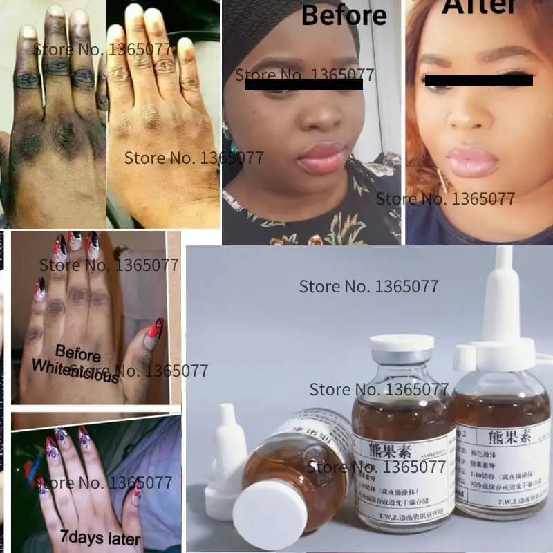 Serum whitening serum whitening for natural skin alpha arbutina sieri permanent whitening essence dark black