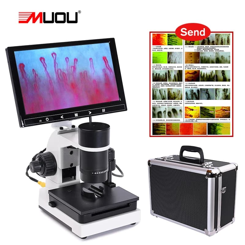 Microscopio digitale monoculare 500X e inferiore microcircolazione sanguigna + monitor LCD a colori 7 "o 9"