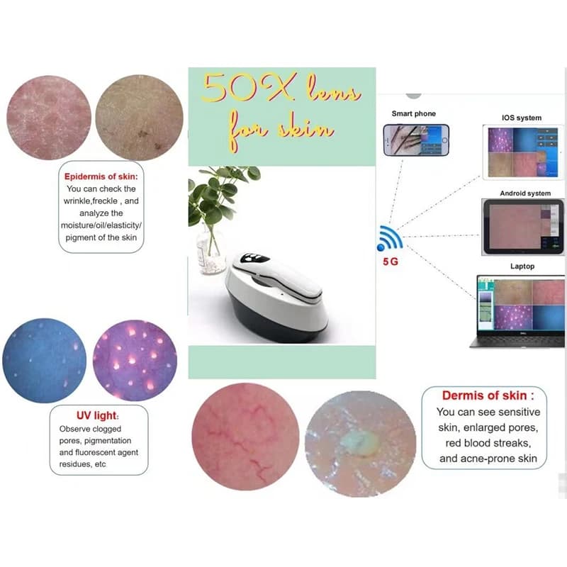 TDOUBEAUTY BM-999 Analizzatore Automatico Wireless Wi-Fi di Pelle e Cuoio Capelluto, Crema per Cucele e Bruciature, Tecnologia di Ricarica Wireless (Rosa)