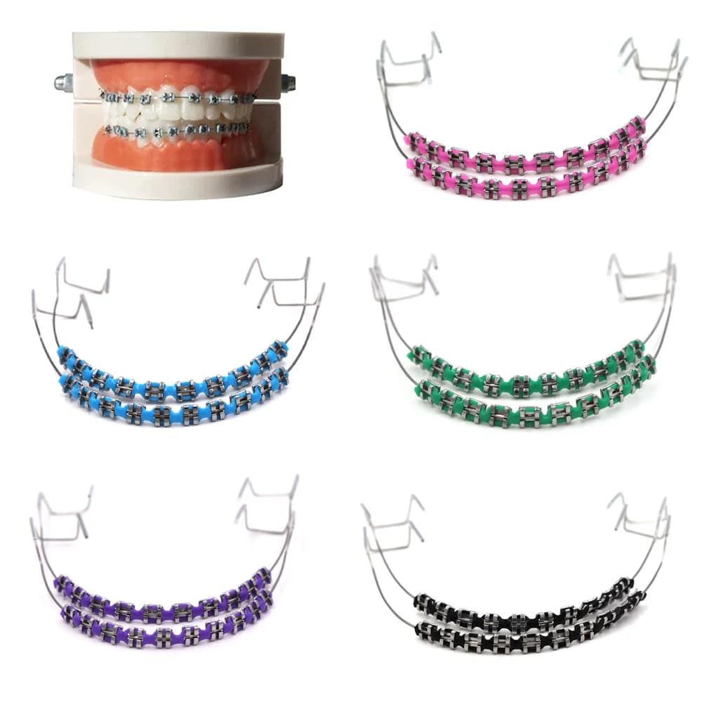 Fashionable fake suspenders kit: coloured orthodontic ties and metal brackets | Safe and comfortable | 1 pair