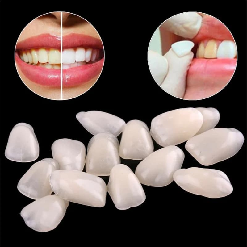 Impiallacciature dentali temporanee: coperture per denti in resina ultrasottile per lo sbiancamento dei denti e l'aumento dei denti anteriori