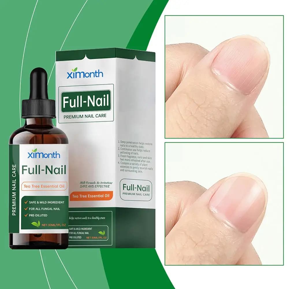 Olio Essenziale di Tea Tree per Funghi delle Unghie 30ml, Rimozione Funghi delle Unghie dei Piedi, Essenza Anti-Infezione per la Cura delle Unghie, Strumenti per la Riparazione dei Piedi 1/3/5 Pezzi