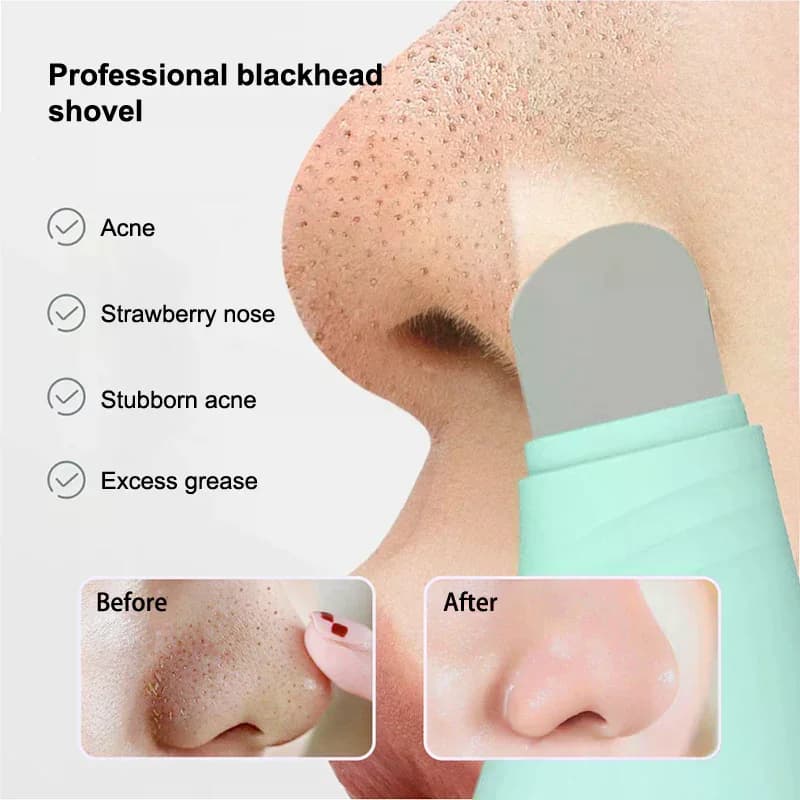 Strumento per la rimozione dei punti neri del viso Raschietto per il viso per la pulizia profonda Viso Acne Fondotinta Spatola Naso Strumento per la cura della pelle per la rimozione dei punti bianchi