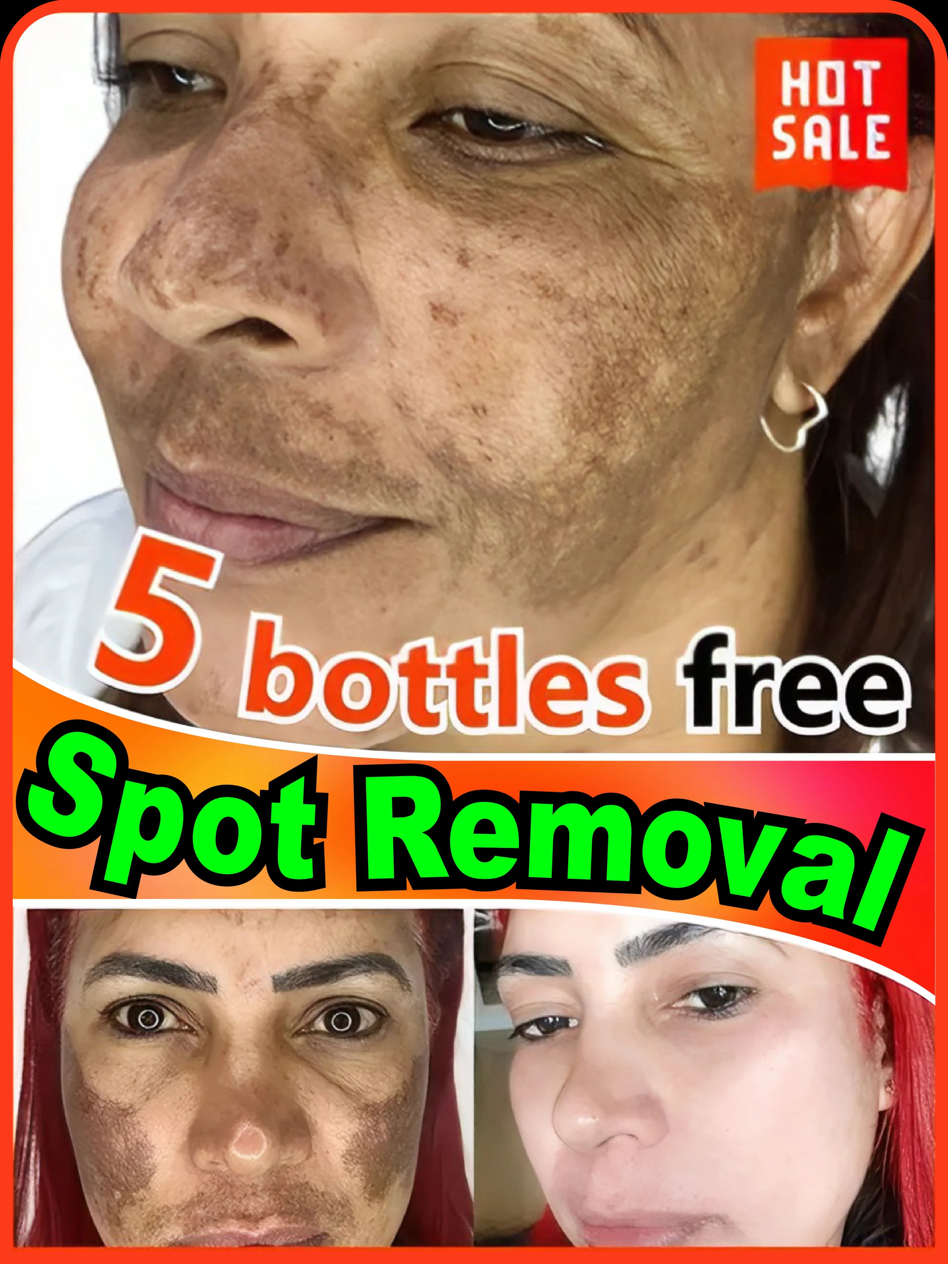 effectively solves all symptoms of pigmentation