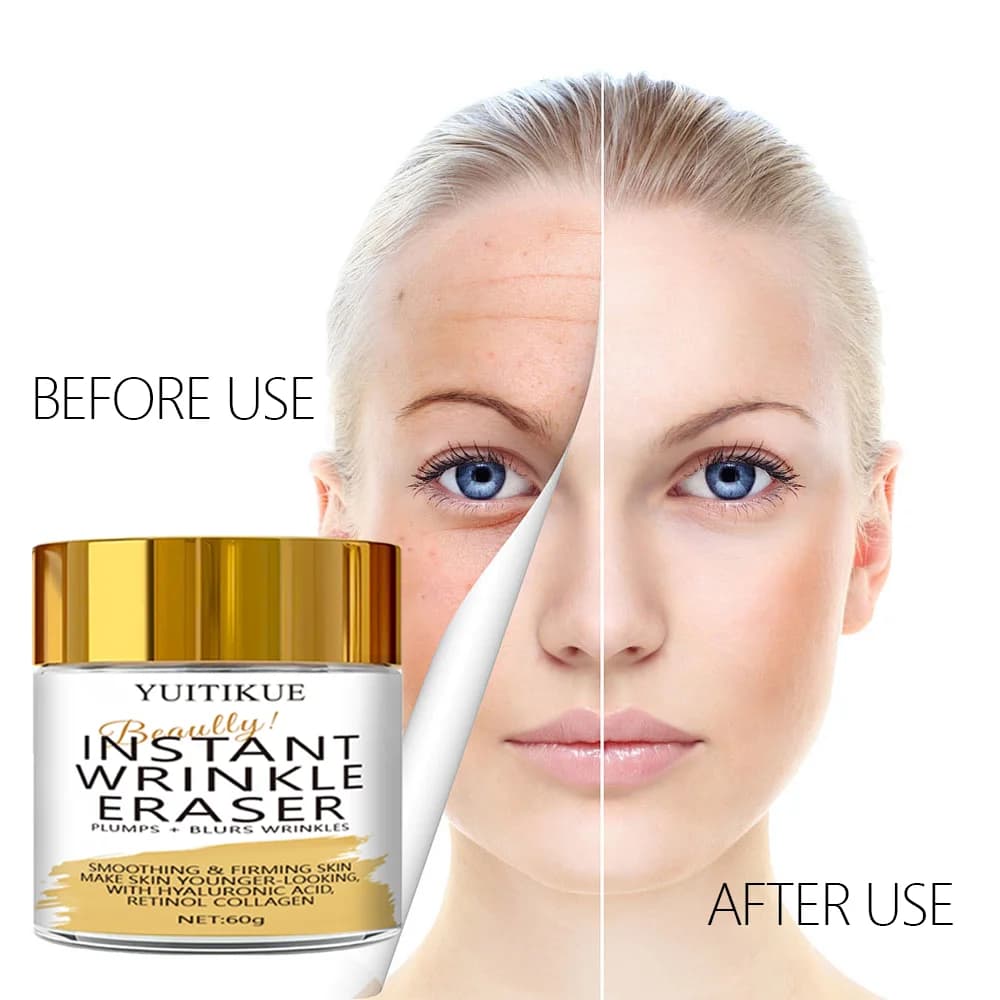 YUITIKUE Gomma antirughe istantanea 60 g - Rimpugnature e sfugge Rughe, Leviga, Firma e Evende Tono, Acido ialuronico Retinolo Collagene