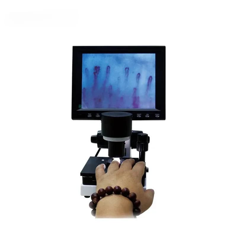 Capillaroscopio per Rilevamento Capillari, Microscopio per Microcircolazione Biologica