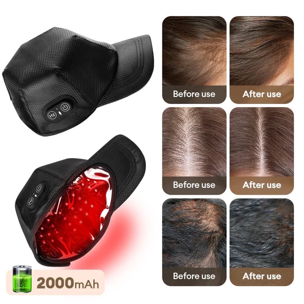 650nm 850nm Cordless Red Light Hair Growth Cap Anti Hair Loss Treatment Hat Target Thinning Scalp Hairline Crown for Men Women