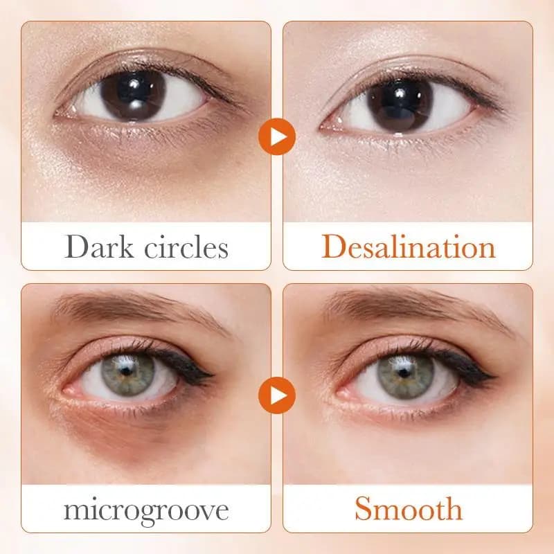 1Pc SADOER Cream Contourno Vitamin C Eyes Anti Occhiaie e Borse, Hydrating, Illuminating and Rassodante, Product for Skin Care