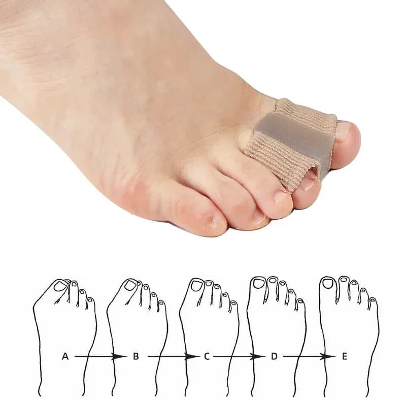 1 Piece Separator Dita in Silicone, Valgo Corrector, Alluce Raddrizer, Foot Care, Orthopedic