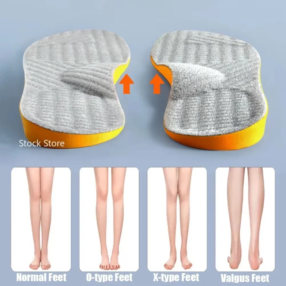 New support for bow plantar foot flat orthopedic orthopedic women shoes boy type X/O legs feet valley correction shoes sports pads