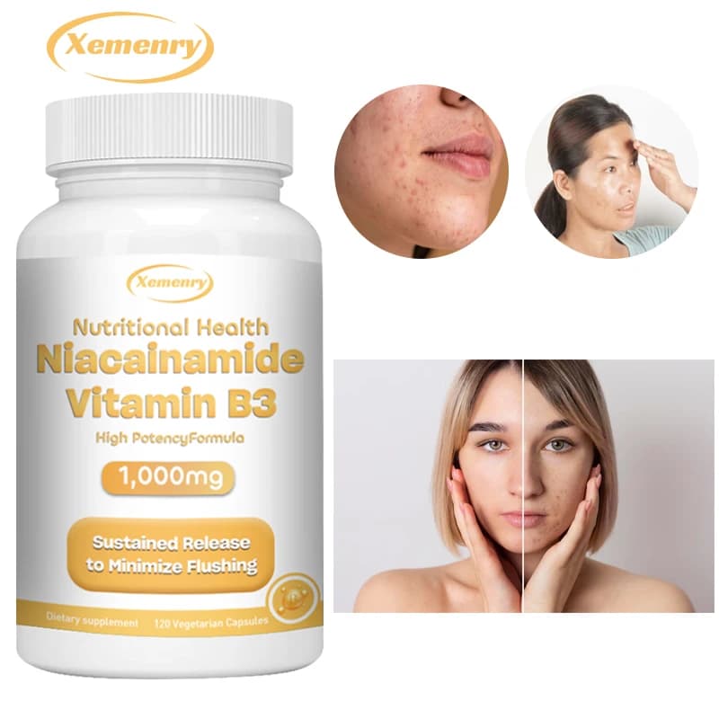 Niacinamide Vitamina B3 1.000 Mg - Integratore alimentare, non OGM
