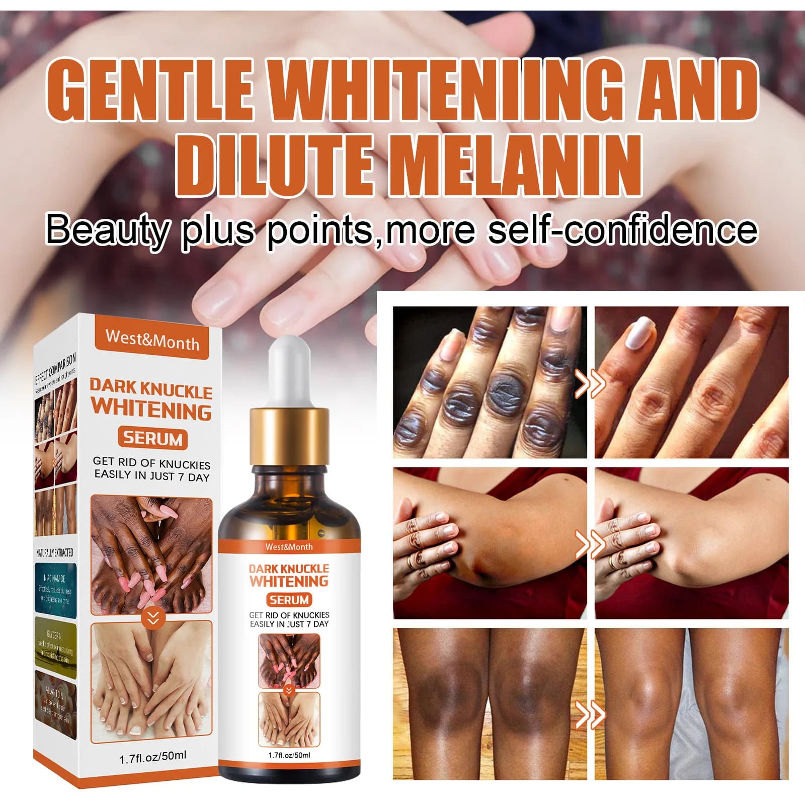Dark Walnuts Lighting Siero Hands Elbows Ginocchio Clearing Oil Intense Macchie Removal Products Beauty care 50ml