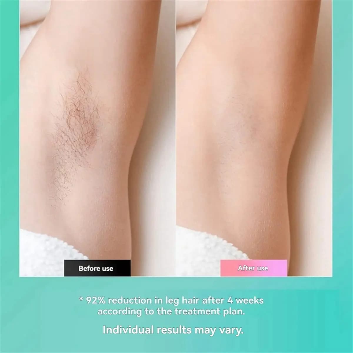 BEST! Laserdepilators for Women and Men, Electric Hair Trimmers, Bikinis, Beard Hair Removal and Beauty Kits EU Plug