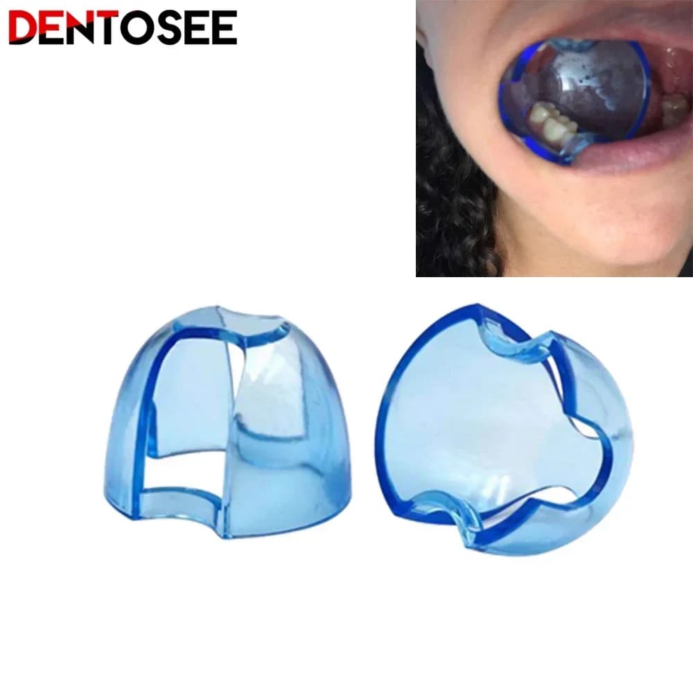 Divaricatore per guance intraorale dentale apri bocca sbiancamento dei denti per denti posteriori anteriori strumenti dentali