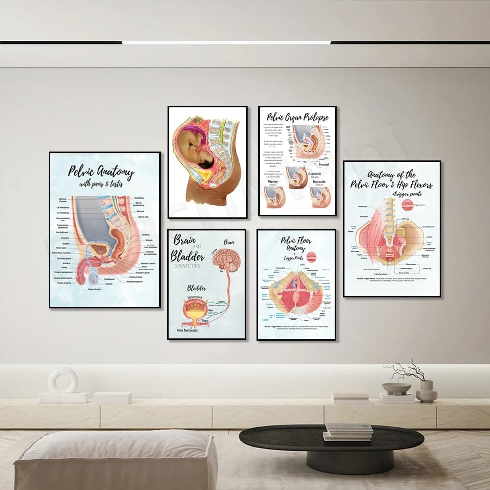 Brain and bladder educational poster, sagittal side view, rectum, pelvic floor and hip flexor + trigger point anatomy poster