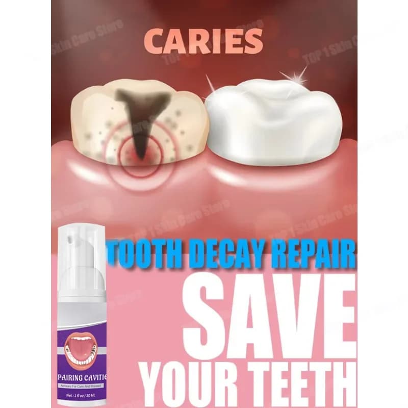 Riparazione della carie dei denti Ripara tutte le cavità, protegge i denti rimuove le macchie della placca Ripara la carie dei denti sbiancamento dei denti Dentale