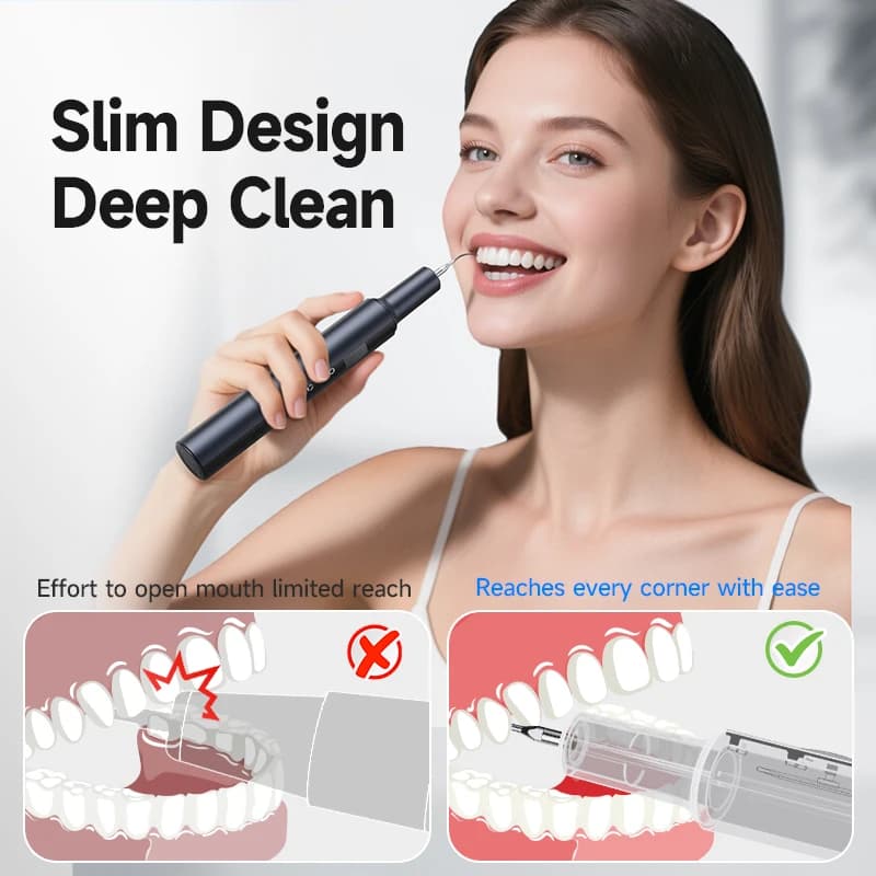 CURVY MOON T7 Electric Tooth Whitening Dental calculator Scaler Plate Coffee Machining Tartar Removal High Frequency Sonic Toothbrush