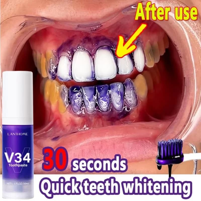 V34 Sbiancamento Dentifricio Rimozione Placca Macchia Viola Correttore Denti Smalto Cura Facile Ridurre Ingiallimento Cura Pulita Orale Nuovo
