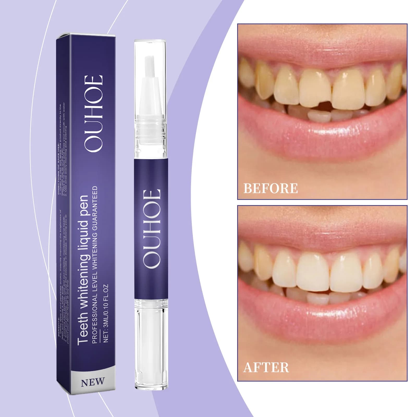 Teeth whitening pen – Gentle care for cleaning, removes smells, stains and yellowings, takes care of teeth