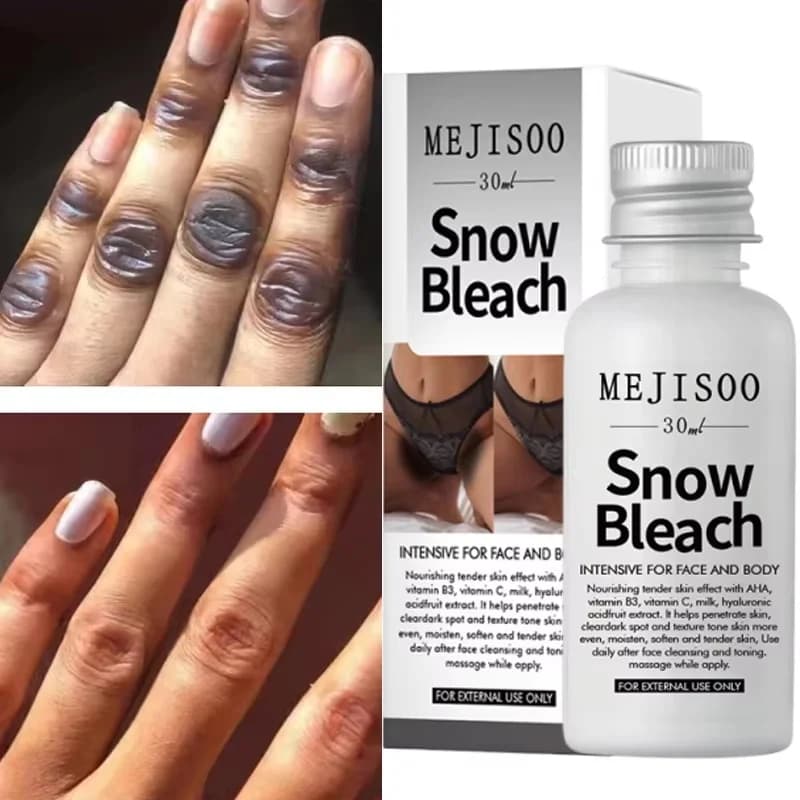 Fast Whitening Dark Knuckles Brighten Hand Cream Melanin Corrector Moisturizing Intense Stains Remover Products Korean Skin Care