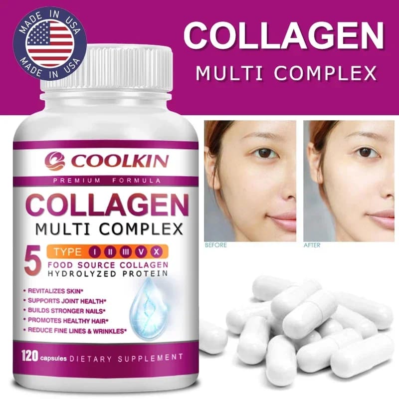 Multicomplesso di collagene - Tipi I, II, III, V, X, Non OGM, Assorbimento migliorato, per capelli sani, ossa, cartilagine, pelle e unghie