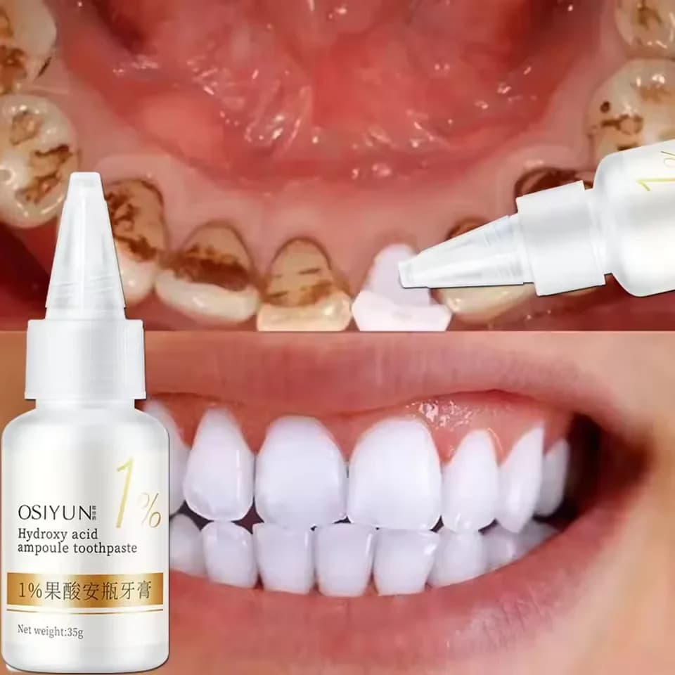 Teeth whitening Dentifricio Fruit acid Remove Calculation Plate Macchie Fresh Food Cleaning Oral Hygiene Dental whitening Care tools