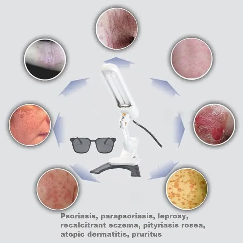 Dispositivo di Fototerapia UVB 311NM per Uso Domestico, Trattamento per Vitiligine e Psoriasi, Lampada Terapeutica UV 311nm
