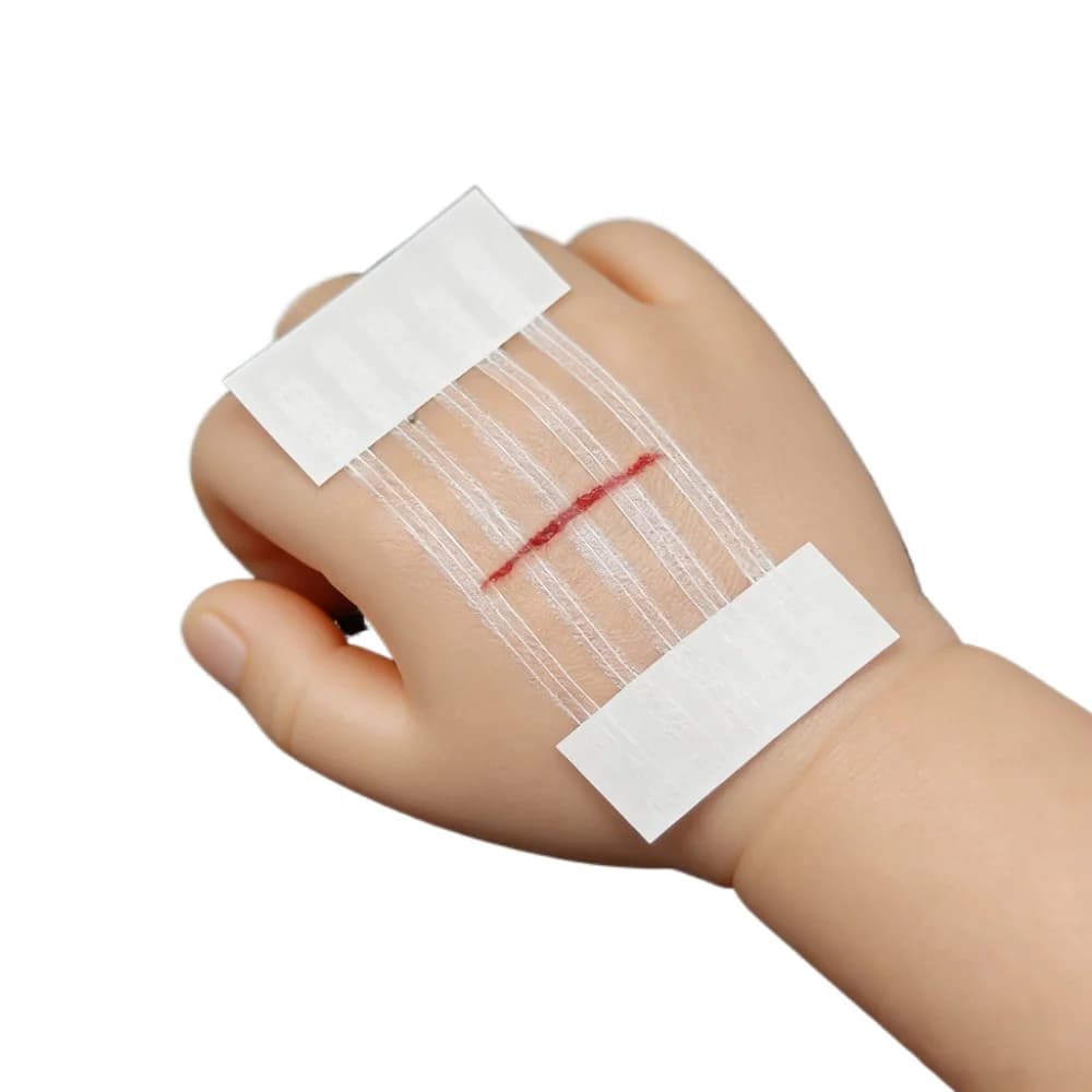 5 Strisce Adesive per Chiusura Ferite, Riparazione Post-Parto, Strisce per Chirurgia Estetica, Nastro Adesivo Medico Senza Sutura