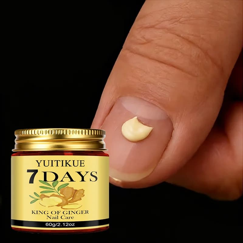 YUITIKUE 7Days Ginger King Nail Care Cream - 7-Day Results, Sterilize & Renew Nails, for Healthy Beautiful Nails 60g