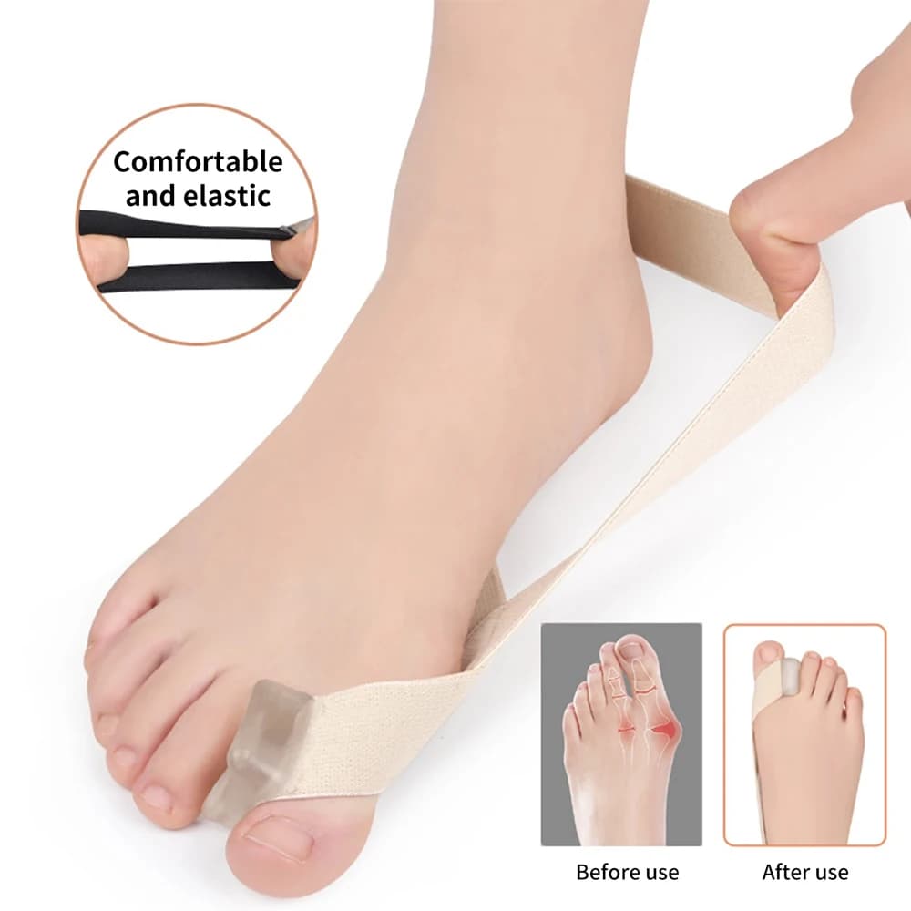 1pc Nuovo Big Toe Raddrizzatore Borsite Ortopedico Borsite Stecca per Alluce Valgo, Confortevole e Traspirante per Il Supporto Giorno/Notte