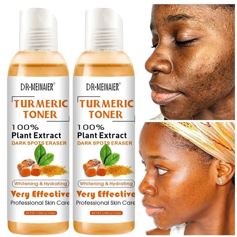 1/2/3 pz Tonico alla Curcuma Illuminante Viso Correttore Macchie Scure Siero Viso Idratante Vitamina C Essenza Zenzero Schiarente Pelle 118ml/pz
