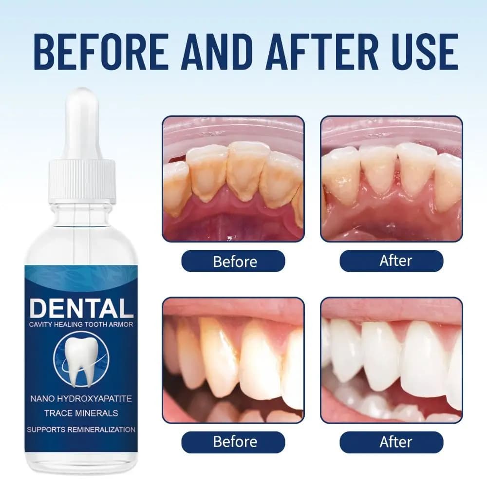 60ml aiuta a mantenere la gomma sana cavità guarigione armatura dei denti rafforzare clinicamente lo smalto dei denti riparazione detentite armatura dei denti liquido