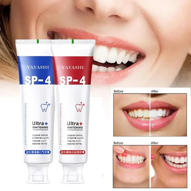 Sbiancamento probiotico Dentifricio squalo Sbiancamento dei denti Previene la placca Dentifricio Dentifricio fresco Igiene orale Strumenti dentali puliti