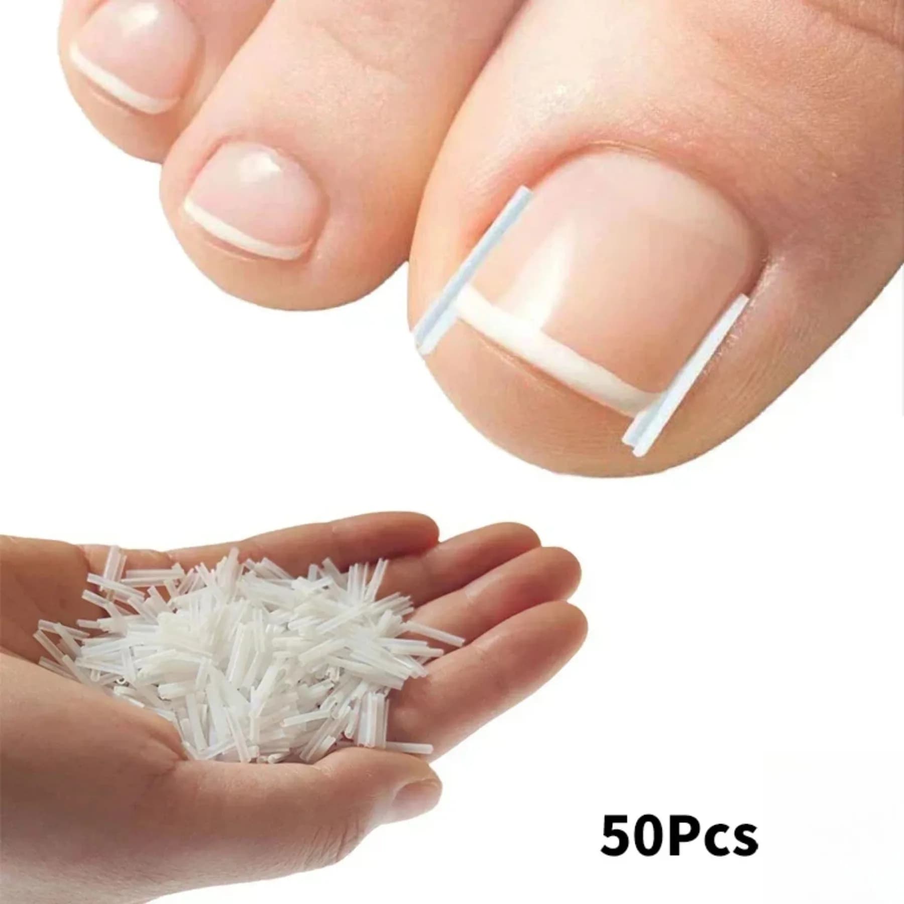 50 pezzi strumento di correzione dell'unghia del piede incarnita trattamento delle unghie dei piedi incarnite adesivo patch elastico raddrizzamento clip tutore strumento per pedicure