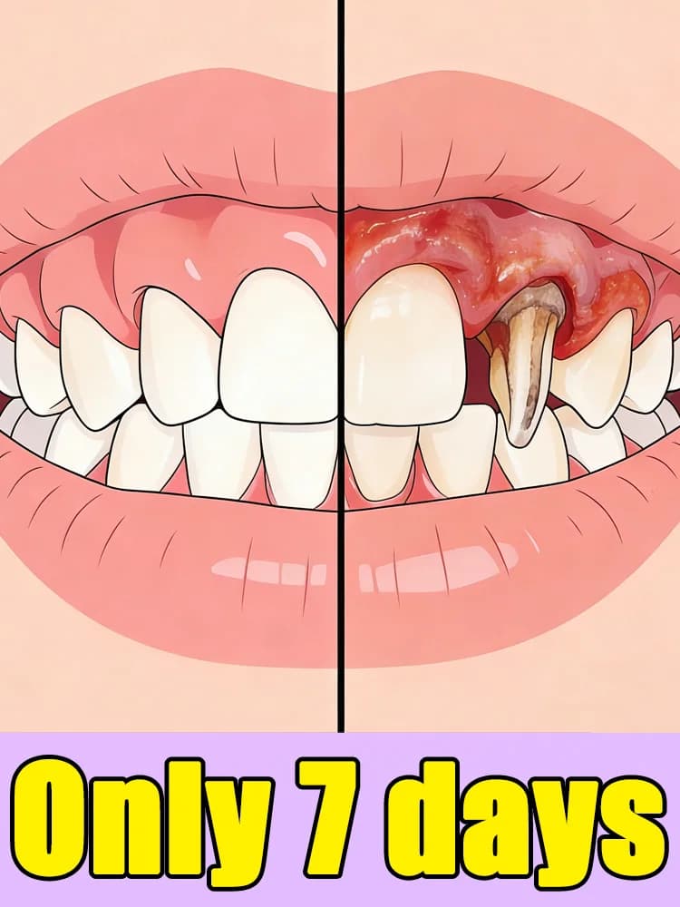 Gengive che crescono, e i denti riprendono la loro salute, olio essenziale per la cura delle gengive