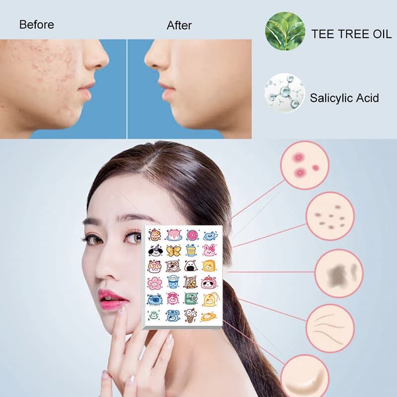 96 animated cartoon cat patches: invisible stickers for skin care treatment