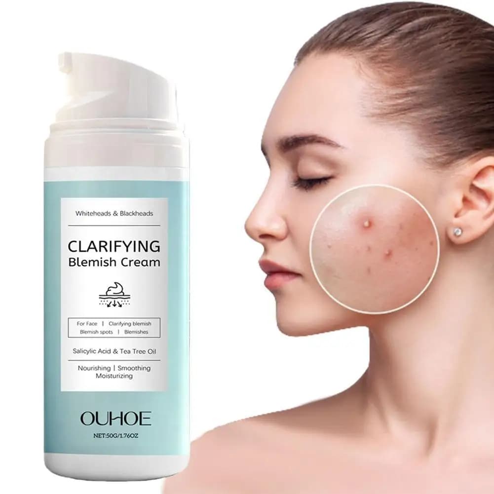 Crema viso all'acido salicilico per il controllo dell'olio della pelle protetta dell'acne Idratante lenitivo leggero non grassa per la pelle combinata