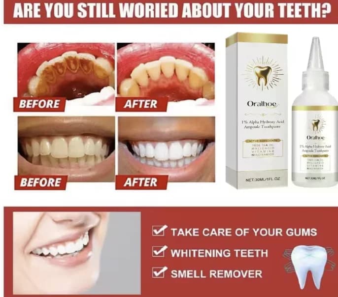 Dentifricio sbiancante - Pulisce in profondità placca e macchie, illumina i denti, attenua l'alito cattivo e rinfresca l'alito