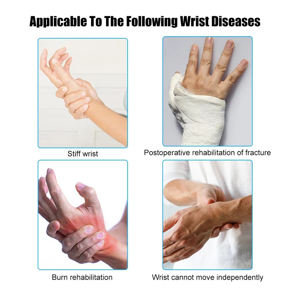 Dispositivo di allenamento per la riabilitazione dell'articolazione del polso della mano Dispositivo di supporto per distorsione del collo della mano del polso dell'emiplegia dell'ictus cerebrale ortodontico fisso