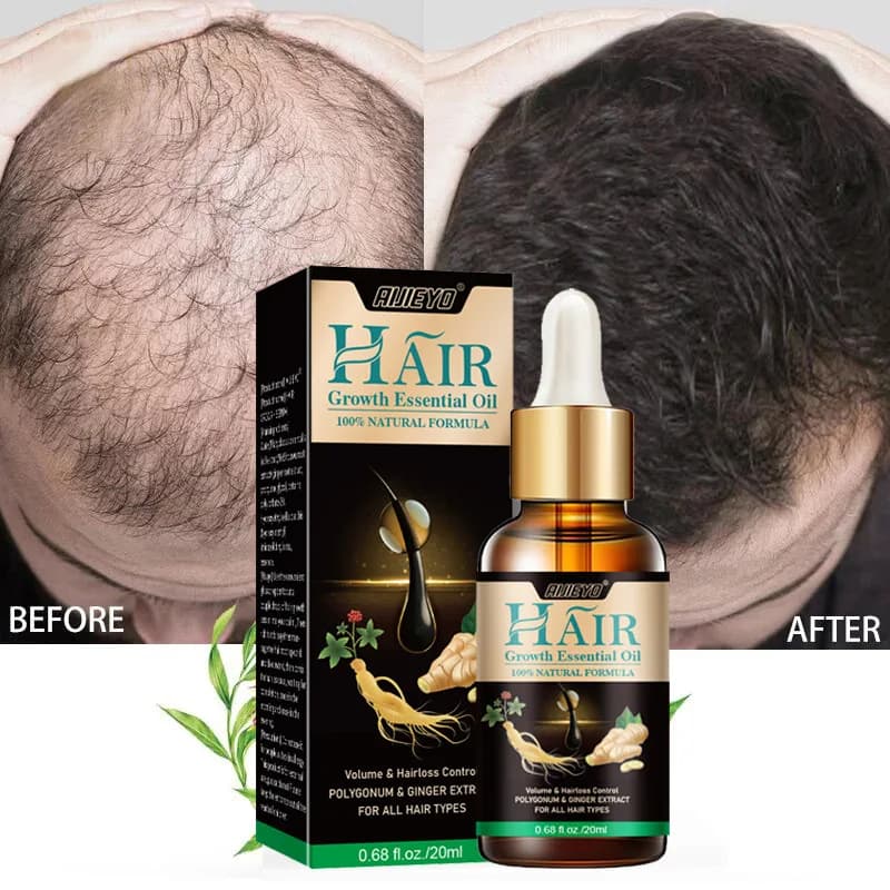 2023 biotin oil for rapid growth of serum hair for regrowth treatment for replenishing liquid Anti-loss for women and men