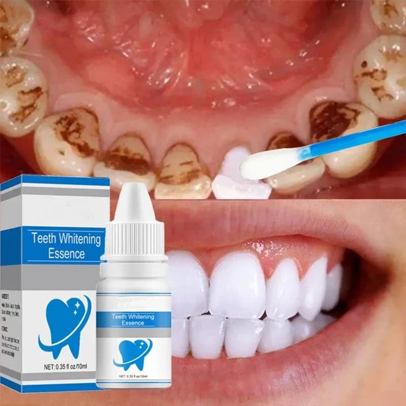 Quick cleaning of teeth White tooth whitening fresh breath Yellow teeth Whitening serum Removing teeth stains Clean serum for plaque NEW