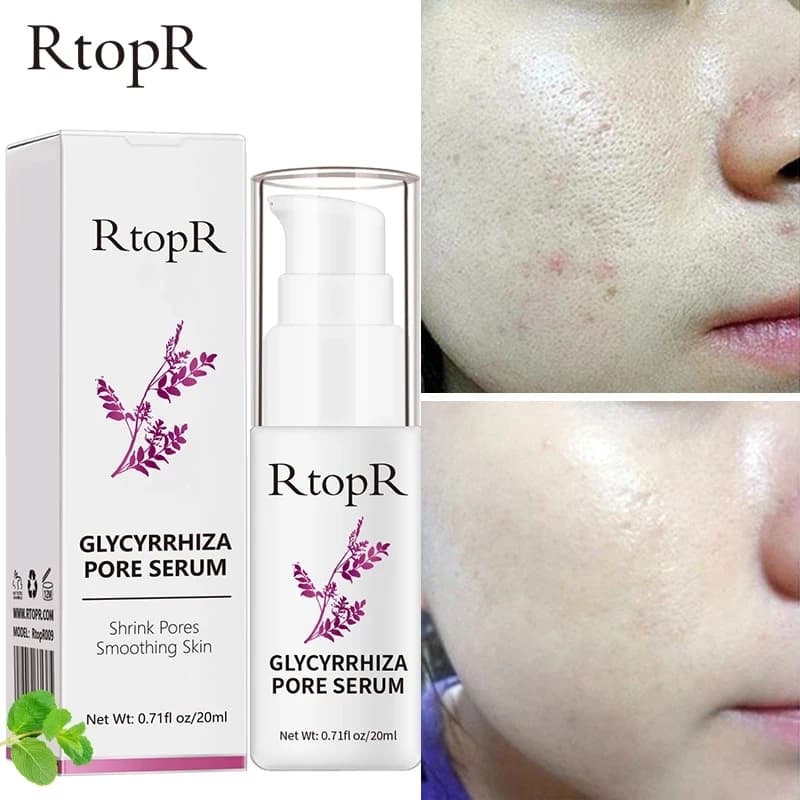 RtopR Glycyrrhiza siero per la riparazione dei pori del viso collagene crema sbiancante antirughe controllo dell'olio idratante efficace ridurre i pori