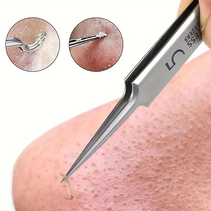Black Dot Removal Tweezers Stainless Steel Tools - Effective Comedone Extractor, White Dot Deep Cleaning Tools