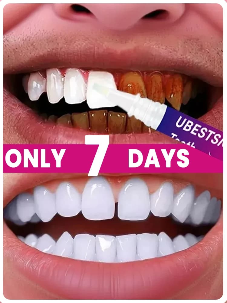 Purple whitening pen, toothpaste to clean the plaque and remove stains, yellowing teeth, not sensitive.