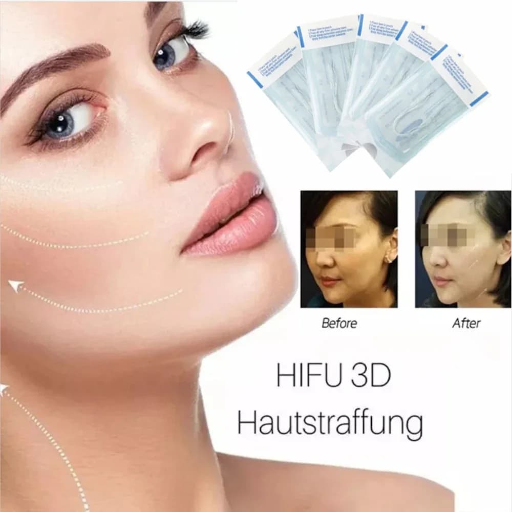 Face Lifting Anti Aging Hyaluronic Clamping Radar Needless Thread Silk Fiber Line Collagen