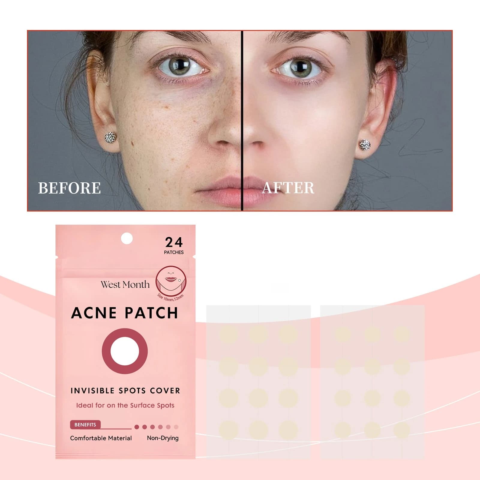 Cerotti Invisibili per Acne e Brufoli, Idratante Delicato per la Pelle del Viso, Trattamento Portatile Idrocolloidale per Pelli a Tendenza Acneica